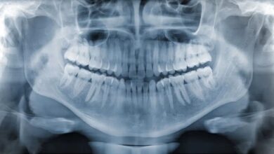 dental x rays